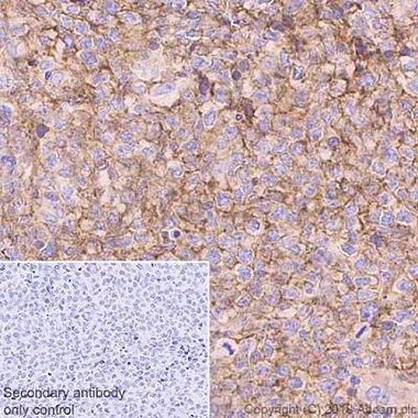 Immunohistochemistry (Formalin/PFA-fixed paraffin-embedded sections) - Anti-CD81 antibody [EPR21916] - BSA and Azide free (AB233692)