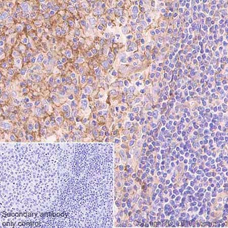 Immunohistochemistry (Formalin/PFA-fixed paraffin-embedded sections) - Anti-CD81 antibody [EPR21916] - BSA and Azide free (AB233692), expandable thumbnail