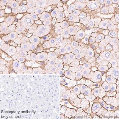 Immunohistochemistry (Formalin/PFA-fixed paraffin-embedded sections) - Anti-CD81 antibody [EPR21916] - BSA and Azide free (AB233692)
