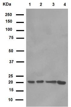Western blot - Anti-CD81 antibody [EPR4244] (AB109201), expandable thumbnail