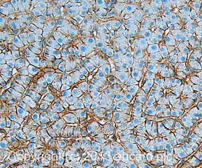 Immunohistochemistry (Formalin/PFA-fixed paraffin-embedded sections) - Anti-CD81 antibody [M38] (AB79559)