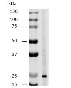 Western blot - Anti-CD81 antibody [M38] (AB79559), expandable thumbnail