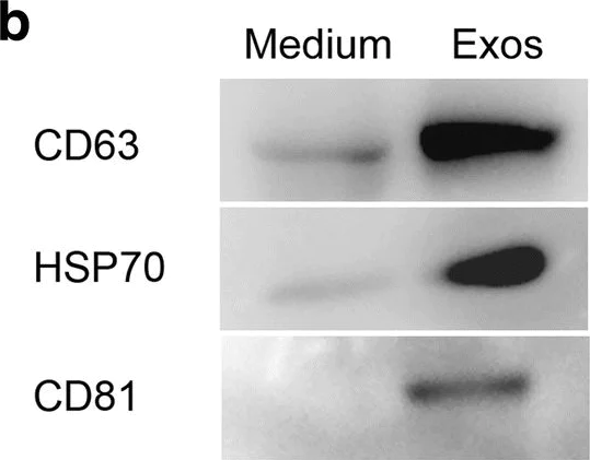 Western blot - Anti-CD81 antibody [TS81] - BSA and Azide free (AB59477)