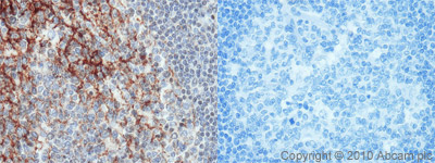 Immunohistochemistry (Formalin/PFA-fixed paraffin-embedded sections) - Anti-CD82 antibody (AB66400)