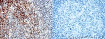 Immunohistochemistry (Formalin/PFA-fixed paraffin-embedded sections) - Anti-CD82 antibody (AB66400)