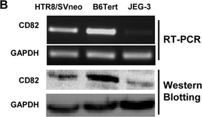 Western blot - Anti-CD82 antibody (AB66400)