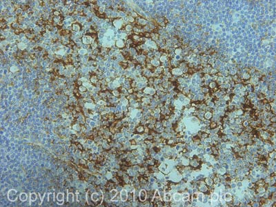 Immunohistochemistry (Formalin/PFA-fixed paraffin-embedded sections) - Anti-CD82 antibody [B-L2] - BSA and Azide free (AB47153)