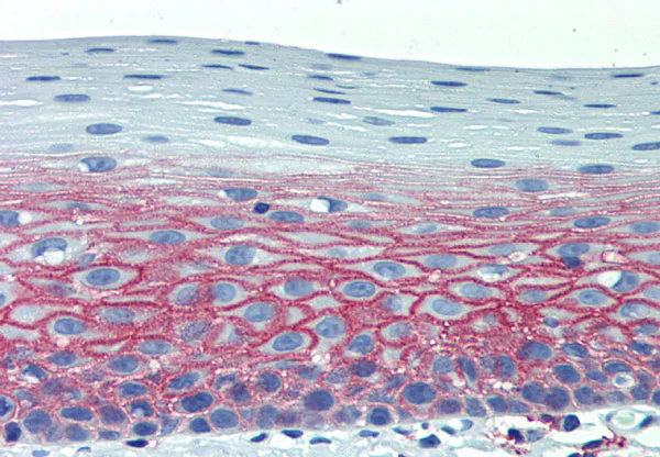 Immunohistochemistry (Formalin/PFA-fixed paraffin-embedded sections) - Anti-CD82 antibody [C33] (AB140238)