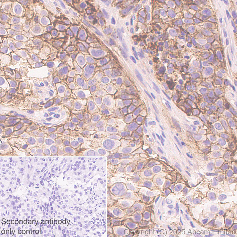 Immunohistochemistry (Formalin/PFA-fixed paraffin-embedded sections) - Anti-CD82 antibody [EPR30214-503] (AB324956)