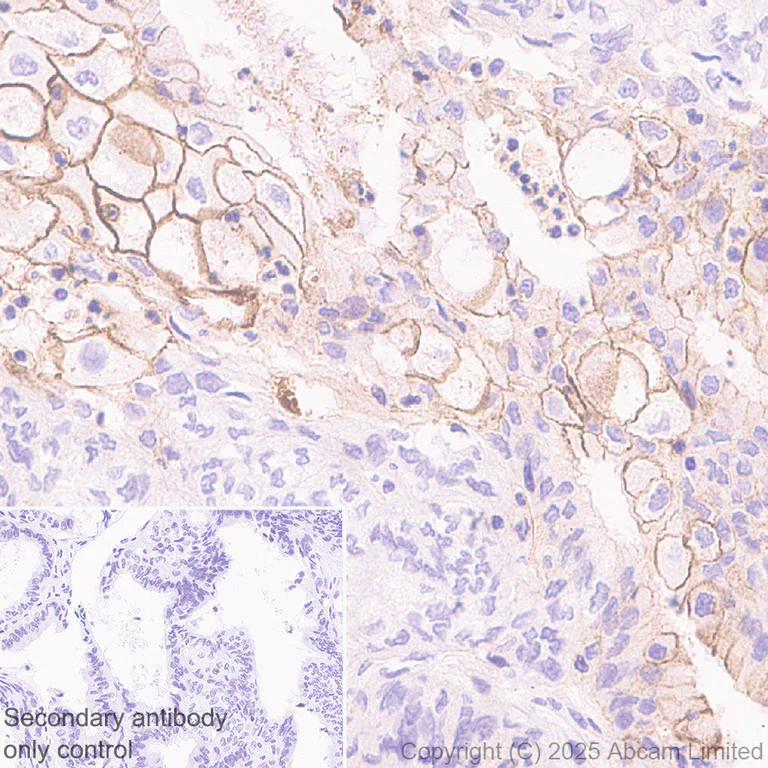 Immunohistochemistry (Formalin/PFA-fixed paraffin-embedded sections) - Anti-CD82 antibody [EPR30214-503] (AB324956)