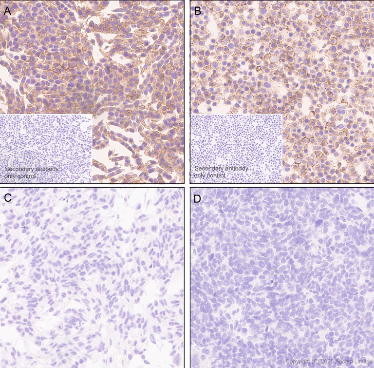 Immunohistochemistry (Formalin/PFA-fixed paraffin-embedded sections) - Anti-CD82 antibody [EPR30214-503] (AB324956)