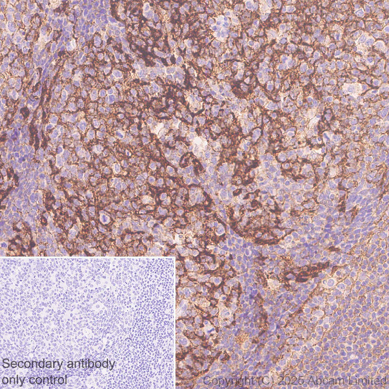 Immunohistochemistry (Formalin/PFA-fixed paraffin-embedded sections) - Anti-CD82 antibody [EPR30214-503] (AB324956)