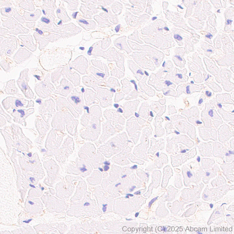 Immunohistochemistry (Formalin/PFA-fixed paraffin-embedded sections) - Anti-CD82 antibody [EPR30214-503] (AB324956)