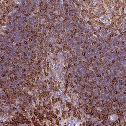 Immunohistochemistry (Formalin/PFA-fixed paraffin-embedded sections) - Anti-CD83 antibody (AB205343), expandable thumbnail