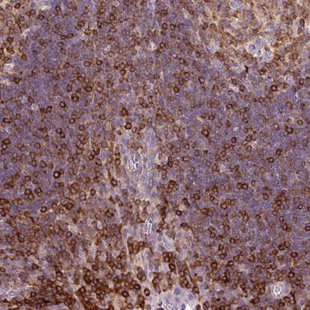 Immunohistochemistry (Formalin/PFA-fixed paraffin-embedded sections) - Anti-CD83 antibody (AB205343)