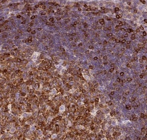 Immunohistochemistry (Formalin/PFA-fixed paraffin-embedded sections) - Anti-CD83 antibody (AB205343), expandable thumbnail