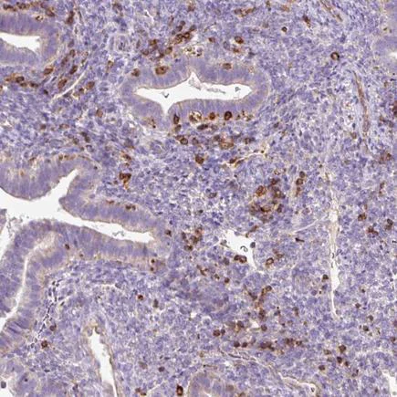 Immunohistochemistry (Formalin/PFA-fixed paraffin-embedded sections) - Anti-CD83 antibody (AB205343)