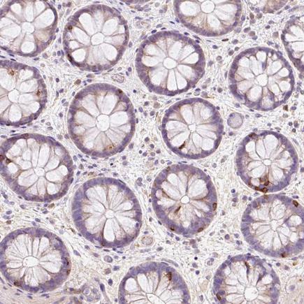 Immunohistochemistry (Formalin/PFA-fixed paraffin-embedded sections) - Anti-CD83 antibody (AB205343), expandable thumbnail