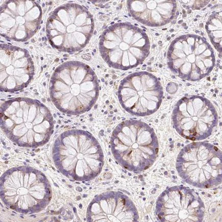 Immunohistochemistry (Formalin/PFA-fixed paraffin-embedded sections) - Anti-CD83 antibody (AB205343)