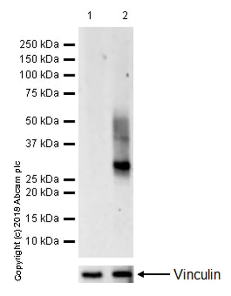 Western blot - Anti-CD83 antibody [EPR22405] (AB244204)