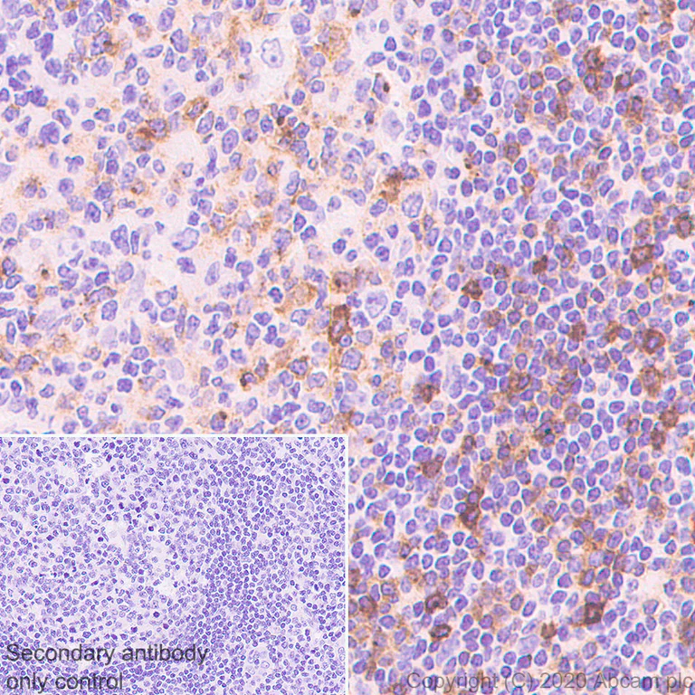 Immunohistochemistry (Formalin/PFA-fixed paraffin-embedded sections) - Anti-CD83 antibody [EPR23809-19] - BSA and Azide free (AB275032)