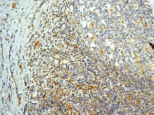 Immunohistochemistry (Formalin/PFA-fixed paraffin-embedded sections) - Anti-CD84 antibody [EPR8325] (AB131256), expandable thumbnail