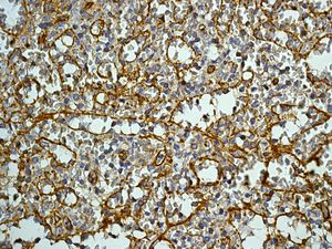 Immunohistochemistry (Formalin/PFA-fixed paraffin-embedded sections) - Anti-CD84 antibody [EPR8325] (AB131256), expandable thumbnail