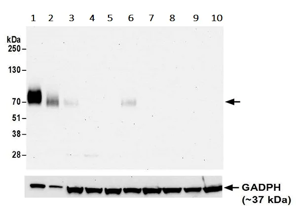 Western blot - Anti-CD86 antibody [BLR029F] - BSA free (AB243886)
