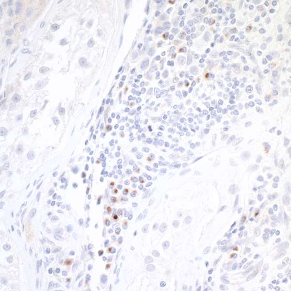 Immunohistochemistry (Formalin/PFA-fixed paraffin-embedded sections) - Anti-CD86 antibody [BLR030F] - BSA free (AB243887), expandable thumbnail