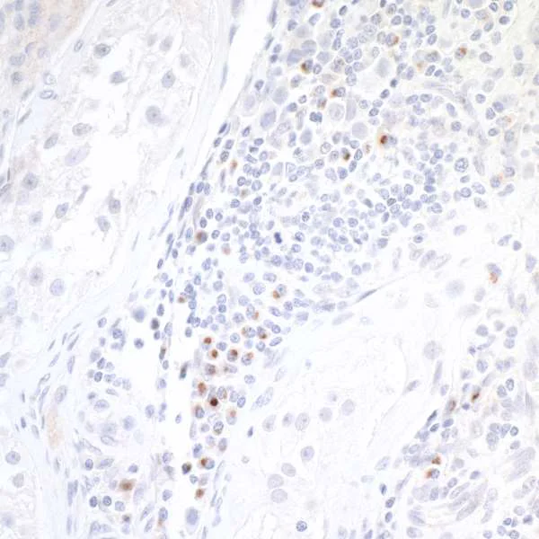 Immunohistochemistry (Formalin/PFA-fixed paraffin-embedded sections) - Anti-CD86 antibody [BLR030F] - BSA free (AB243887)