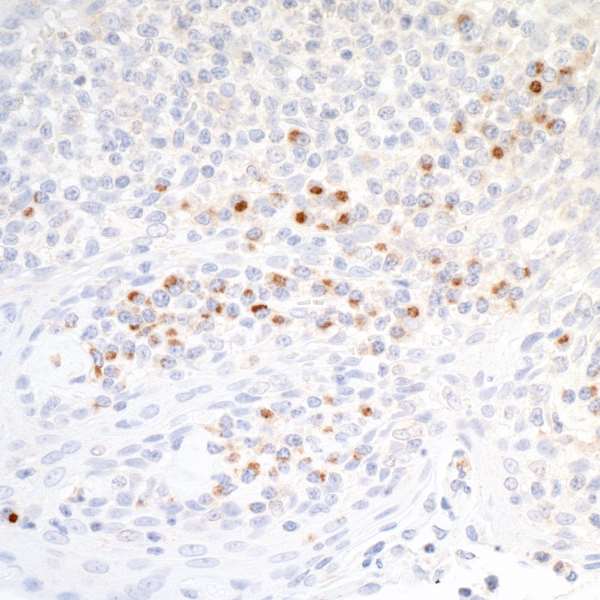 Immunohistochemistry (Formalin/PFA-fixed paraffin-embedded sections) - Anti-CD86 antibody [BLR030F] - BSA free (AB243887), expandable thumbnail