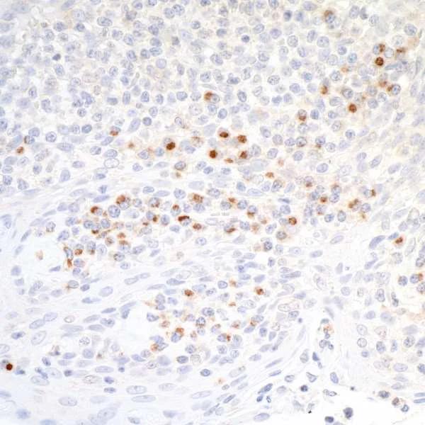 Immunohistochemistry (Formalin/PFA-fixed paraffin-embedded sections) - Anti-CD86 antibody [BLR030F] - BSA free (AB243887)