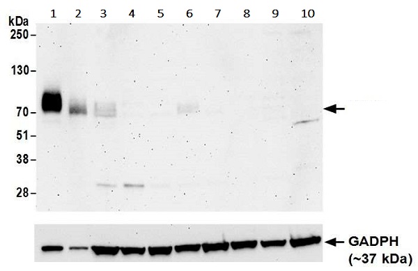 Western blot - Anti-CD86 antibody [BLR030F] - BSA free (AB243887), expandable thumbnail