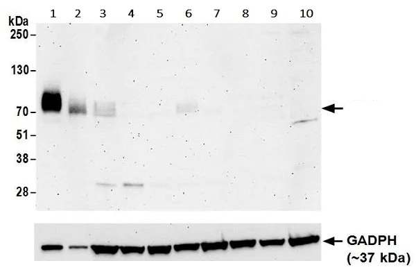 Western blot - Anti-CD86 antibody [BLR030F] - BSA free (AB243887)