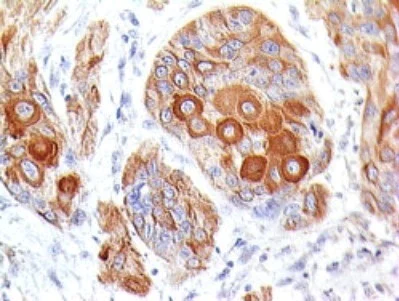 Immunohistochemistry (Formalin/PFA-fixed paraffin-embedded sections) - Anti-CD86 antibody [BU63] (AB234000)