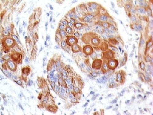 Immunohistochemistry (Formalin/PFA-fixed paraffin-embedded sections) - Anti-CD86 antibody [BU63] - BSA and Azide free (AB213044)