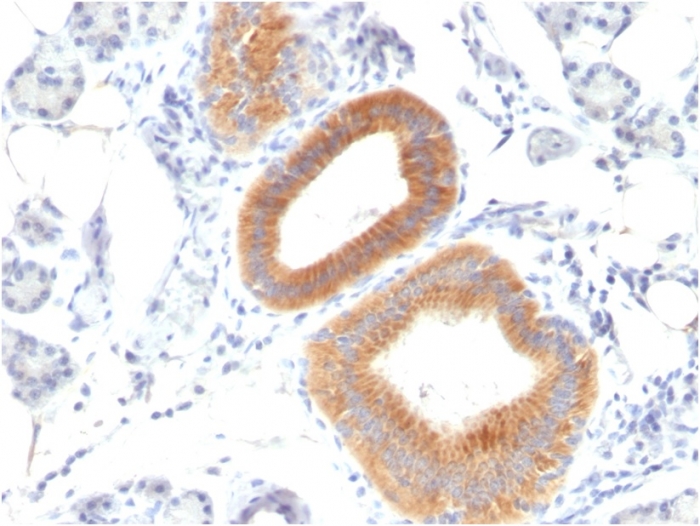 Immunohistochemistry (Formalin/PFA-fixed paraffin-embedded sections) - Anti-CD86 antibody [C86/1146] (AB220188), expandable thumbnail