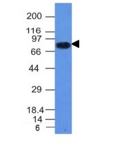 Western blot - Anti-CD86 antibody [C86/1146] (AB220188), expandable thumbnail