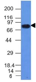 Western blot - Anti-CD86 antibody [C86/1146] - BSA and Azide free (AB213045)