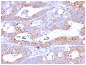 Immunohistochemistry (Formalin/PFA-fixed paraffin-embedded sections) - Anti-CD86 antibody [C86/2160R] (AB234401)