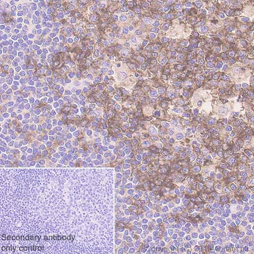Immunohistochemistry (Formalin/PFA-fixed paraffin-embedded sections) - Anti-CD86 antibody [EP1158-37] - BSA and Azide free (AB269593)