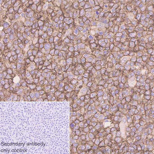 Immunohistochemistry (Formalin/PFA-fixed paraffin-embedded sections) - Anti-CD86 antibody [EP1158-37] - BSA and Azide free (AB269593)