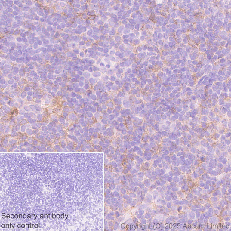 Immunohistochemistry (Formalin/PFA-fixed paraffin-embedded sections) - Anti-CD86 antibody [EPR22958-113] - BSA and Azide free (Detector) (AB305361)