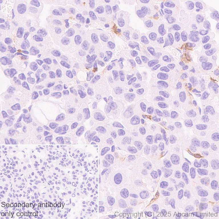 Immunohistochemistry (Formalin/PFA-fixed paraffin-embedded sections) - Anti-CD86 antibody [EPR22958-113] - BSA and Azide free (Detector) (AB305361)