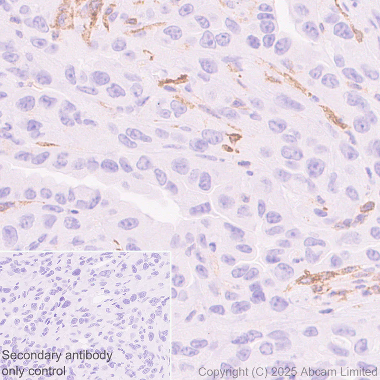 Immunohistochemistry (Formalin/PFA-fixed paraffin-embedded sections) - Anti-CD86 antibody [EPR22958-113] - BSA and Azide free (Detector) (AB305361)