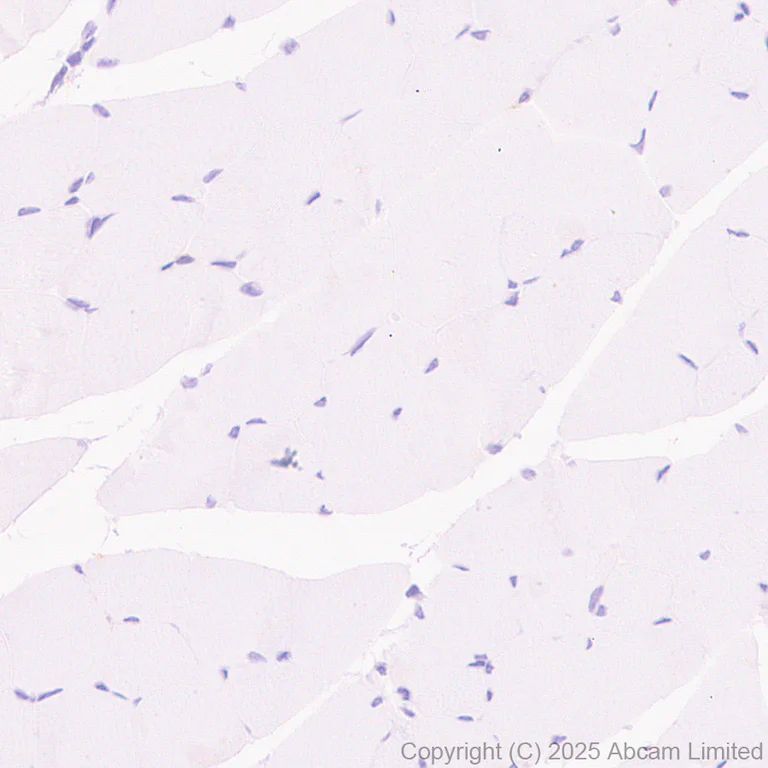 Immunohistochemistry (Formalin/PFA-fixed paraffin-embedded sections) - Anti-CD86 antibody [EPR22958-113] - BSA and Azide free (Detector) (AB305361)