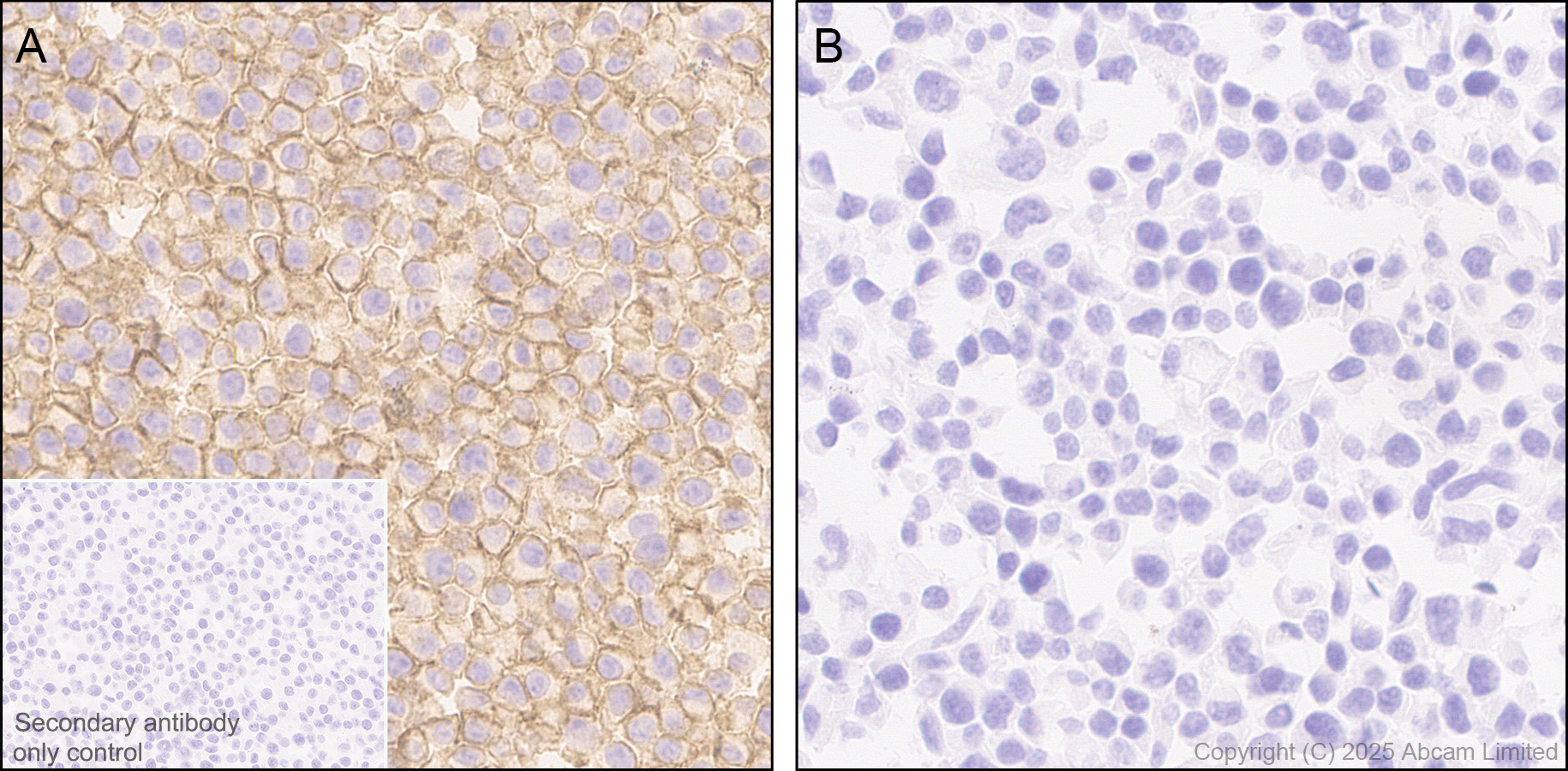 Immunohistochemistry (Formalin/PFA-fixed paraffin-embedded sections) - Anti-CD86 antibody [EPR22958-113] - BSA and Azide free (Detector) (AB305361)