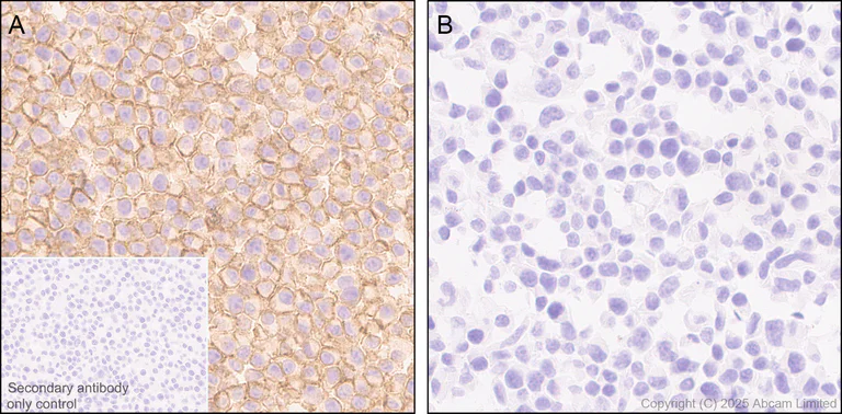Immunohistochemistry (Formalin/PFA-fixed paraffin-embedded sections) - Anti-CD86 antibody [EPR22958-113] - BSA and Azide free (Detector) (AB305361)