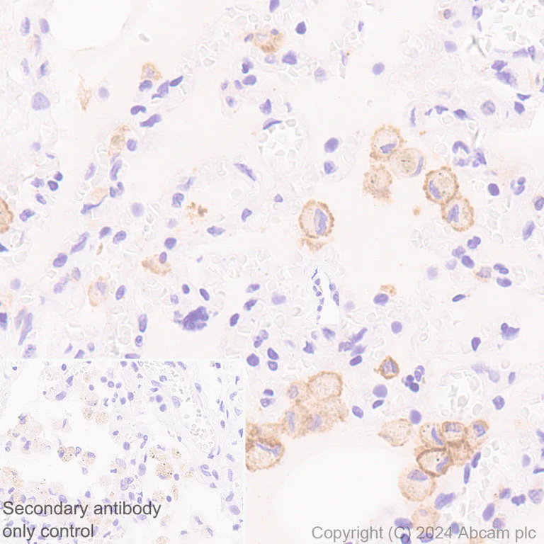 Immunohistochemistry (Formalin/PFA-fixed paraffin-embedded sections) - Anti-CD86 antibody [EPR28721-30] - BSA and Azide free (AB317267)