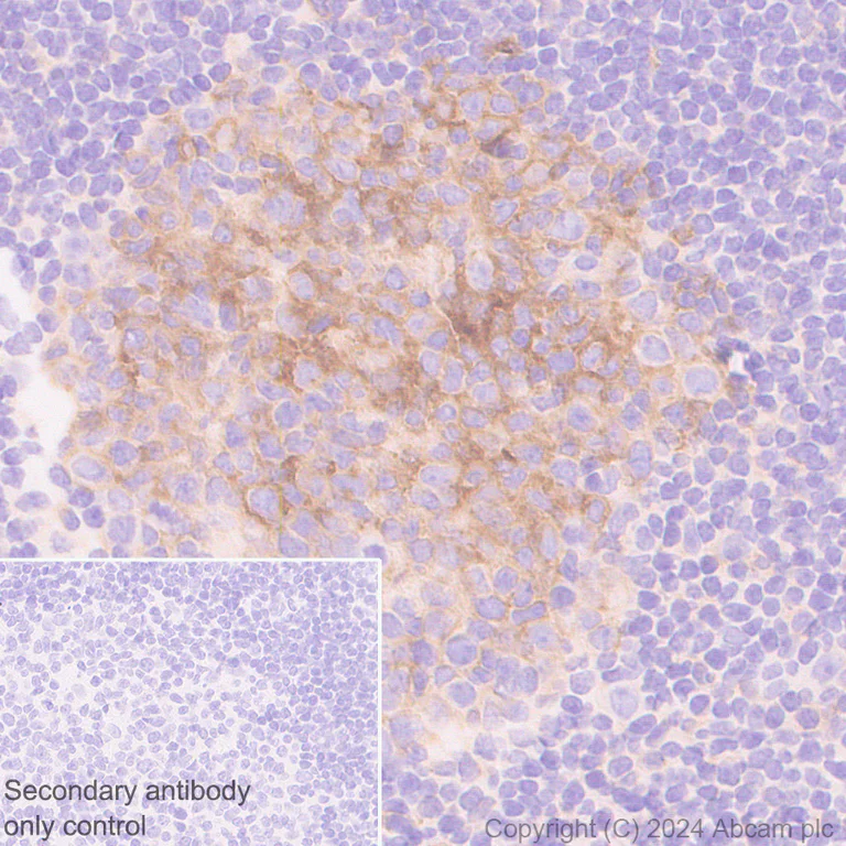 Immunohistochemistry (Formalin/PFA-fixed paraffin-embedded sections) - Anti-CD86 antibody [EPR28721-30] - BSA and Azide free (AB317267)